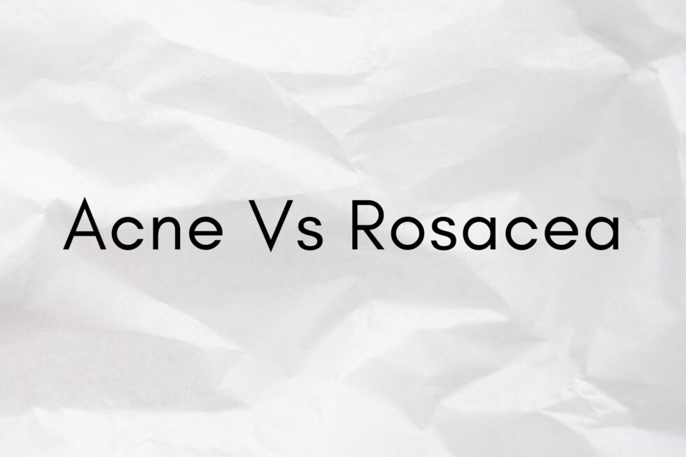 acne-vs-rosacea-how-to-identify-geosmatic