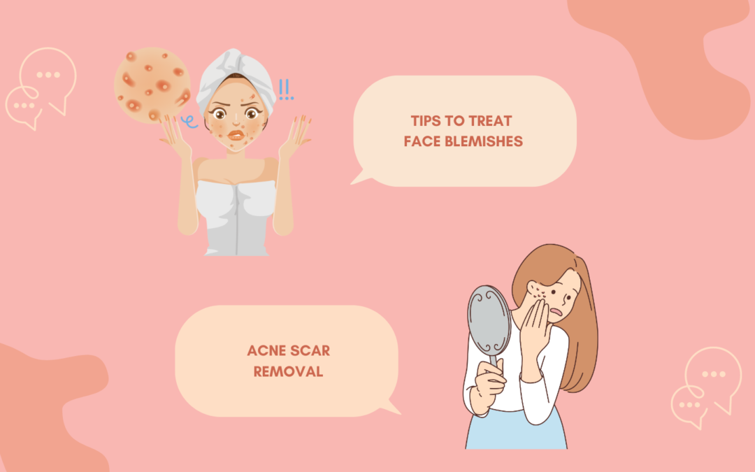 TIPS TO TREAT FACE BLEMISHES