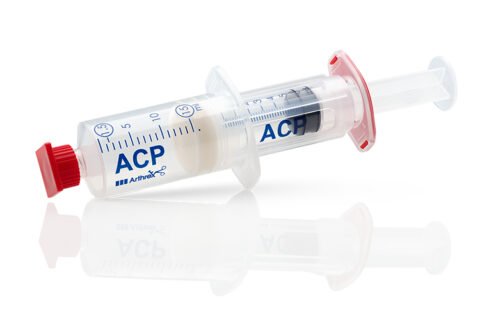 Next Gen PRP - Arthrex ACP - geosmatic